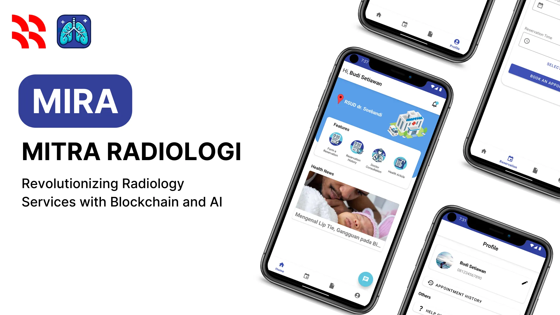 MIRA - Mitra Radiologi